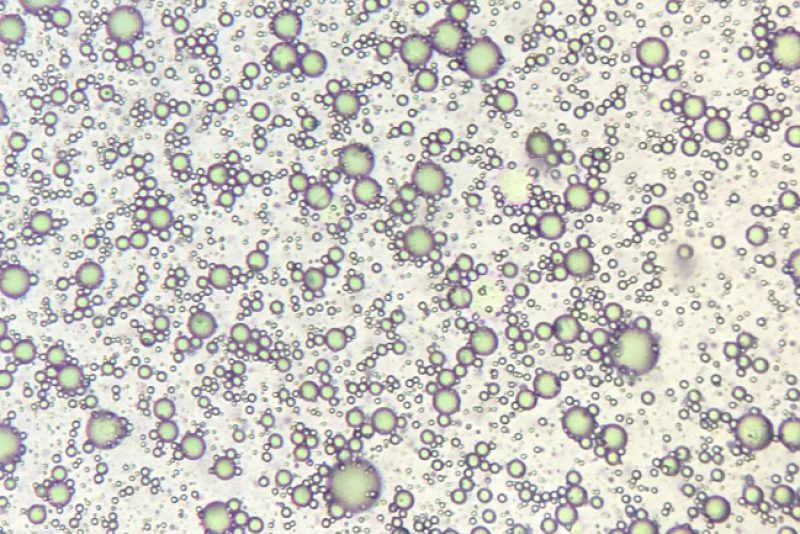 microalgae seen from under a microscope